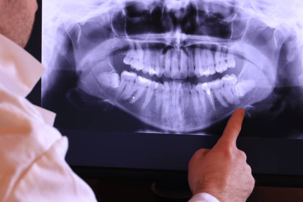 Best Same-Day Emergency Dental Services in Nebo, NC