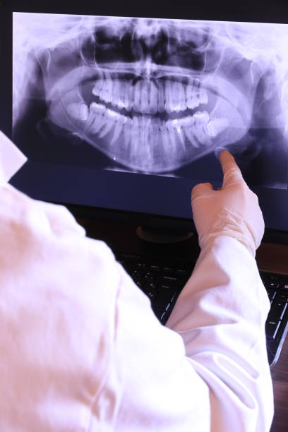 Best Urgent Care for Lost Fillings or Crowns in Nebo, NC