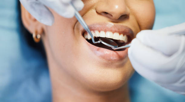 Best Emergency Wisdom Teeth Removal in Nebo, NC