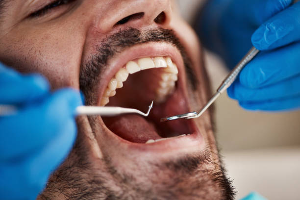 Best Weekend Emergency Dentist in Nebo, NC