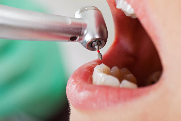 Best Same-Day Emergency Dental Services in Nebo, NC